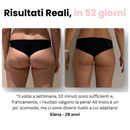Velora™ - Massaggiatore Anti Cellulite
