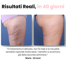 Velora™ - Massaggiatore Anti Cellulite