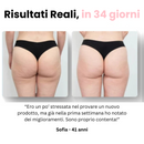 Velora™ - Massaggiatore Anti Cellulite